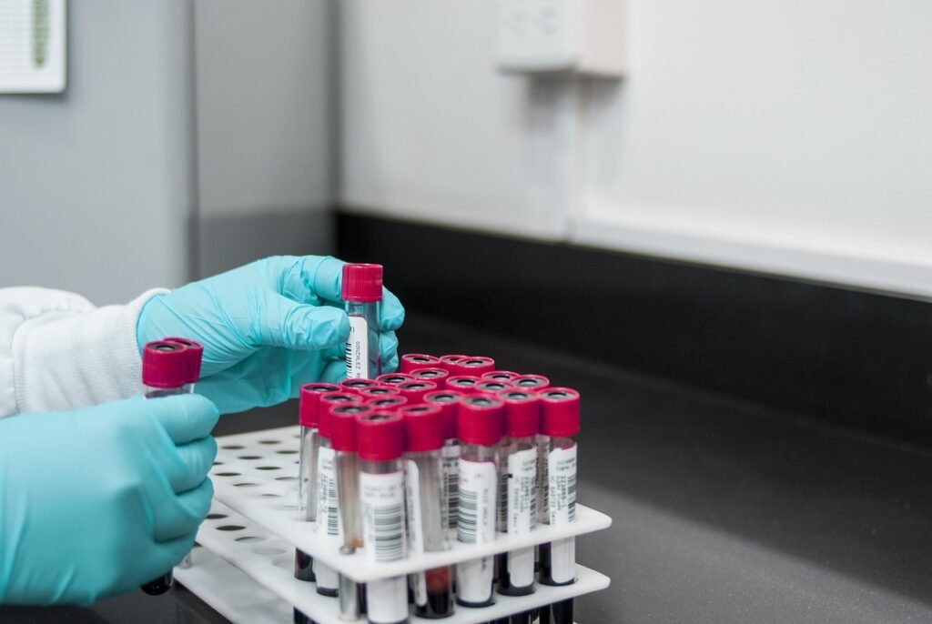 Senior Citizen Wellness Package lab, experiment, test, chemistry, test tubes, laboratory, hands, gloves, surgical gloves, blood samples, lab, lab, lab, lab, lab, chemistry, laboratory, laboratory, laboratory, laboratory