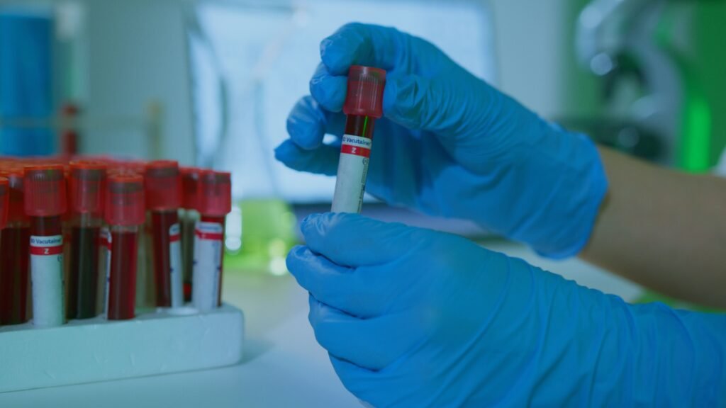 Standard Health Packages (SHP) A detailed view of gloved hands holding blood vials in a lab setting, illustrating medical research.