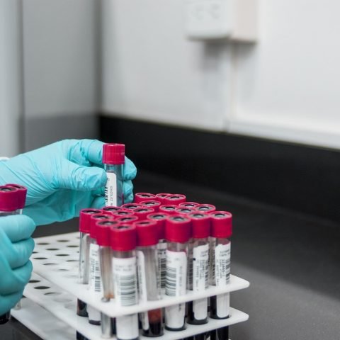 lab, experiment, test, chemistry, test tubes, laboratory, hands, gloves, surgical gloves, blood samples, lab, lab, lab, lab, lab, chemistry, laboratory, laboratory, laboratory, laboratory