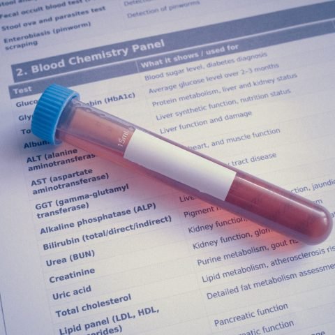 A blood sample tube placed on a chemistry panel document, showcasing medical testing.