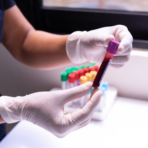 Gloved hands carefully handling a blood sample in a medical or laboratory environment.