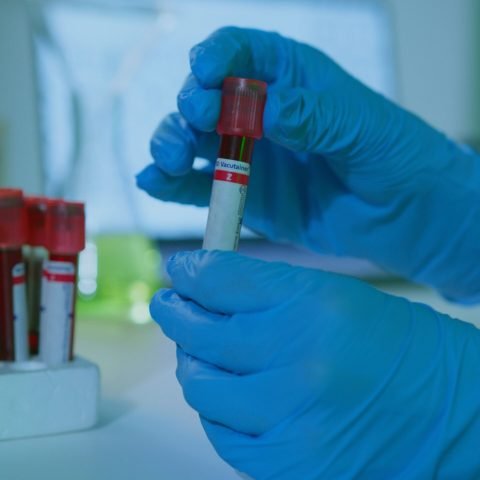 A detailed view of gloved hands holding blood vials in a lab setting, illustrating medical research.